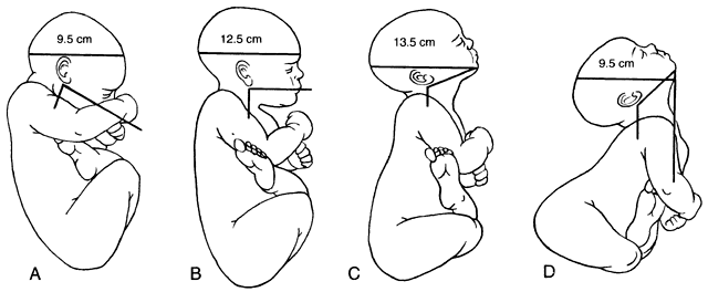 fetal head position